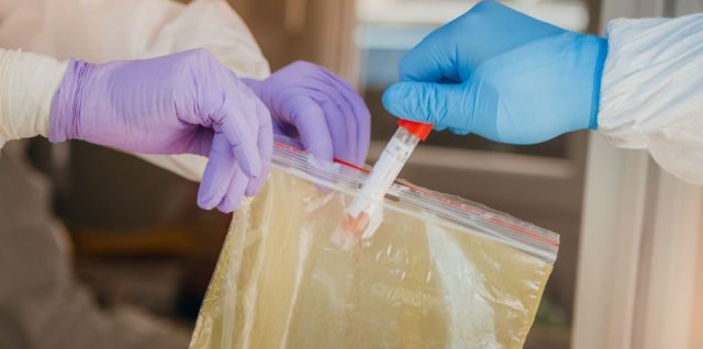 Covid-19, koronavírus